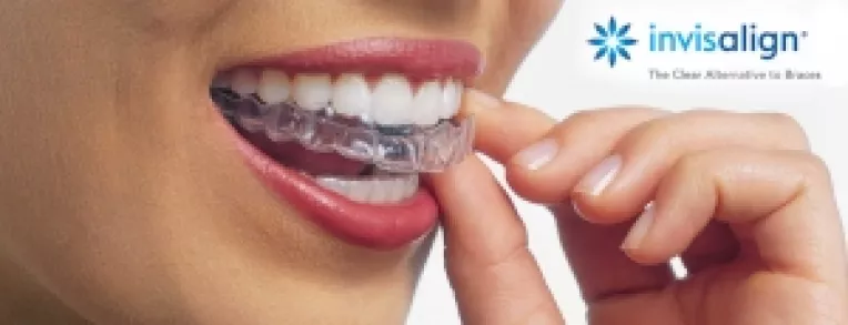 Aparatul dentar Invisalign, confortabil, transparent si detasabil
